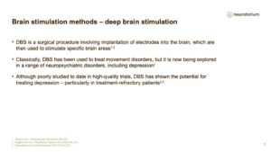 Brain stimulation methods – deep brain stimulation